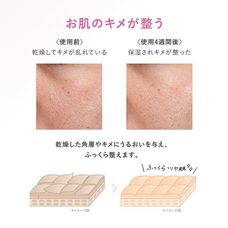 【限定】タイムシークレット 薬用デイエッセンスバーム サクララッシュの香り_04
